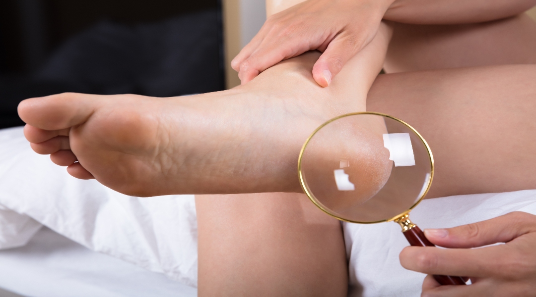 置物 the wound does not heal How Do I Know If I Have a Non-Healing Wound?